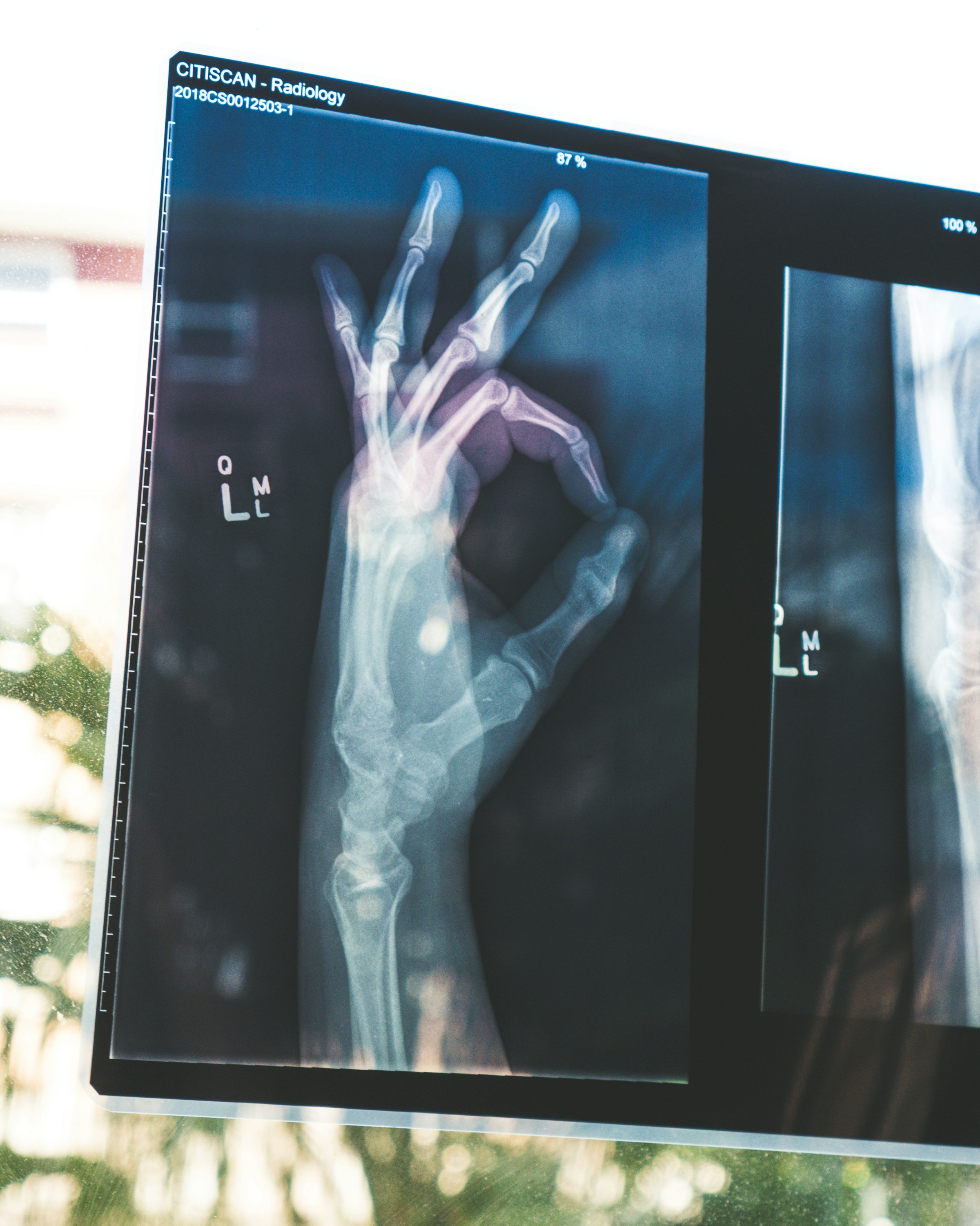 Robotic Surgery Volume Outcomes Featured Silkroad Medtour Clinical Advisory